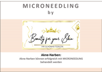 Beauty for your Skin Microneedling Folie 2 f&uuml;r Video Aknenarben by Beauty for your SKin